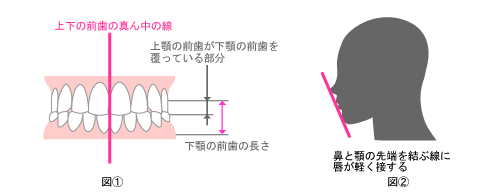 妊娠中はなぜお口の環境が悪化しやすいかを知ろう！