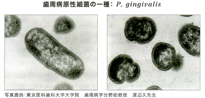 歯周病原性細菌の一種